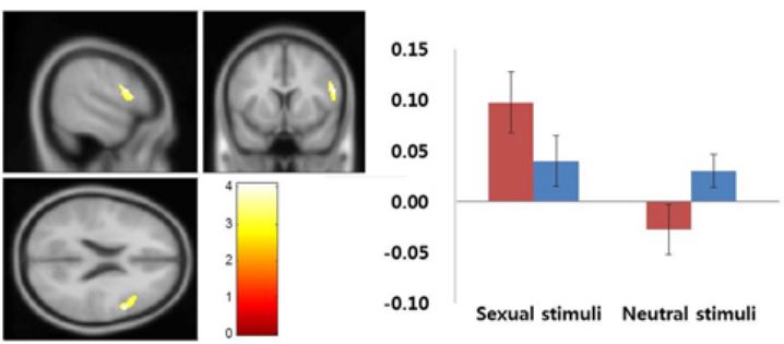 Anx Sex Com - Brain Studies on Porn Users & Sex Addicts - Your Brain On Porn